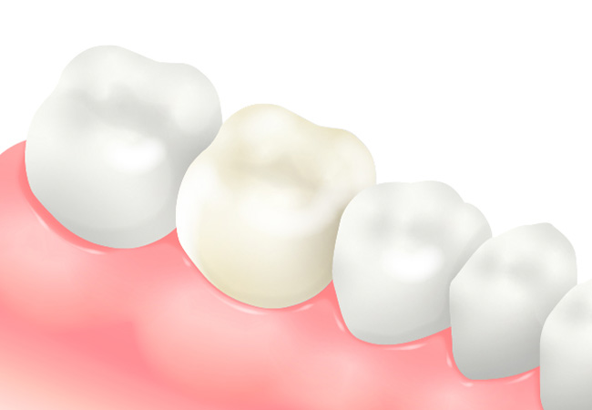 ホワイトクラウン